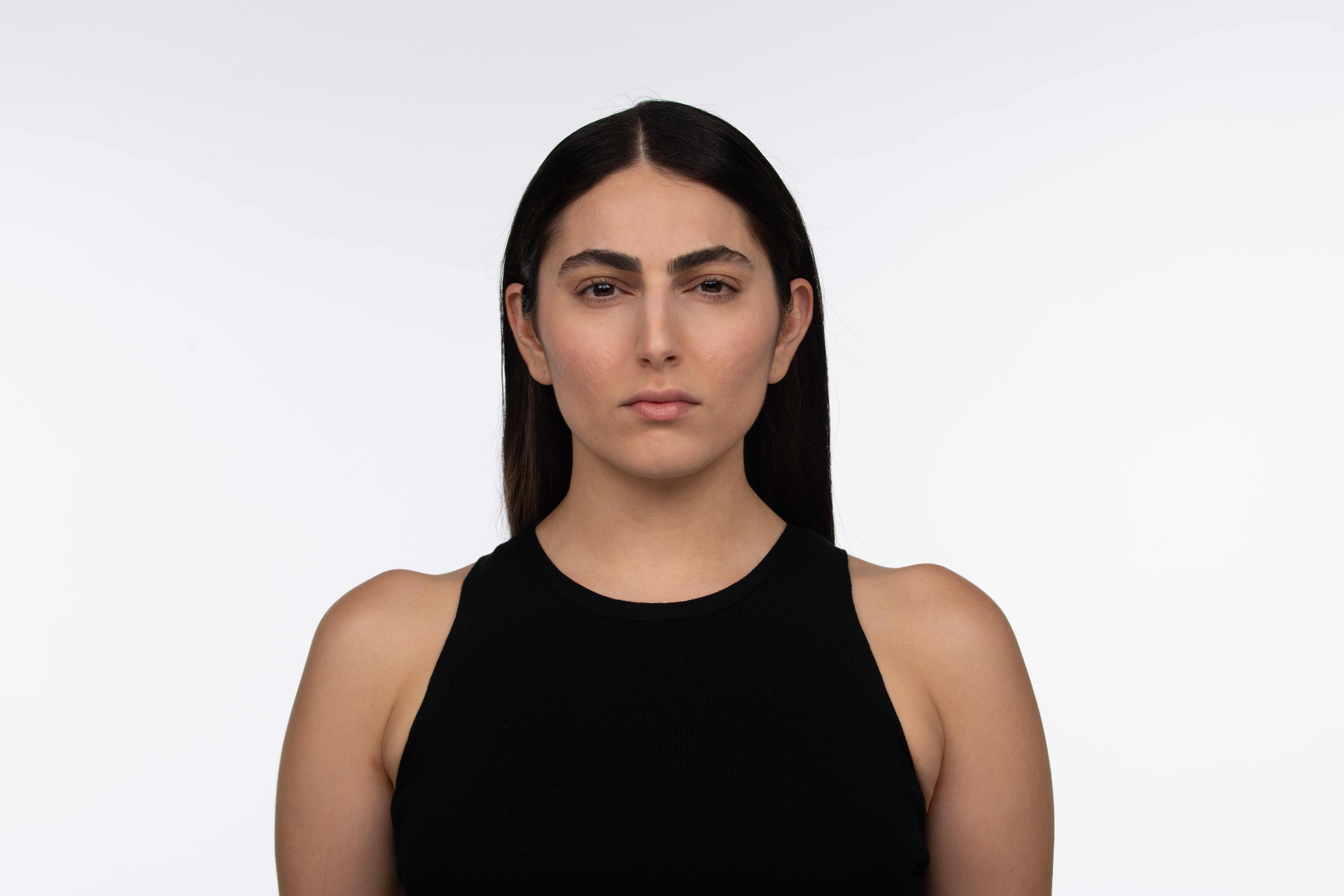 After Jeuveau treatment showing smooth forehead and reduced frown lines - Female patient
