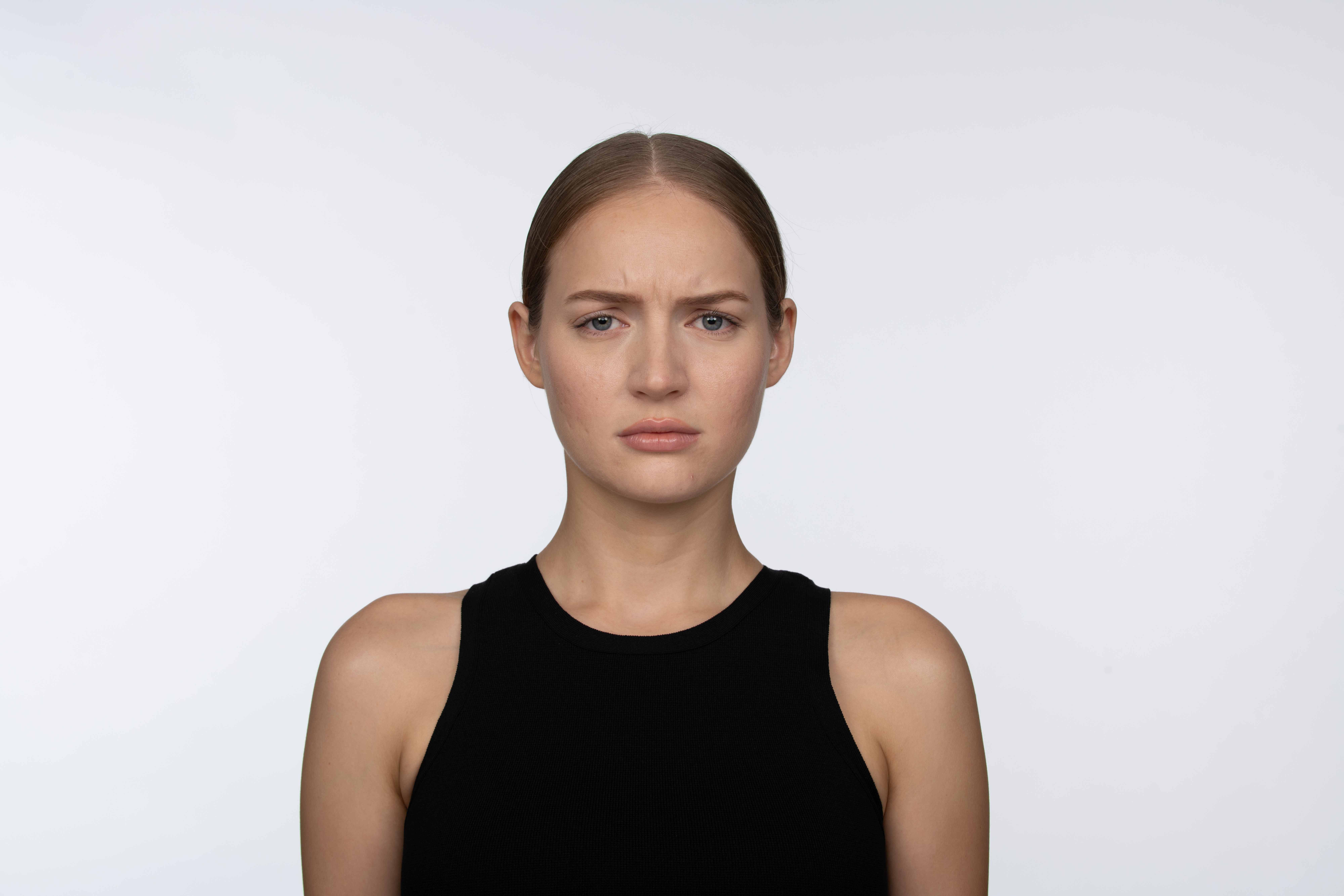 Woman with visible frown lines before Jeuveau treatment